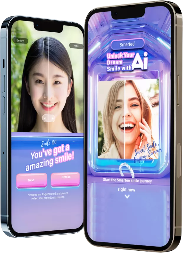 Предварительный просмотр улыбки с питанием от AI