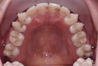Интраоральные фотографии