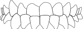 Перекрестный