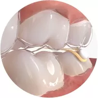 Интерактивные Резинки
